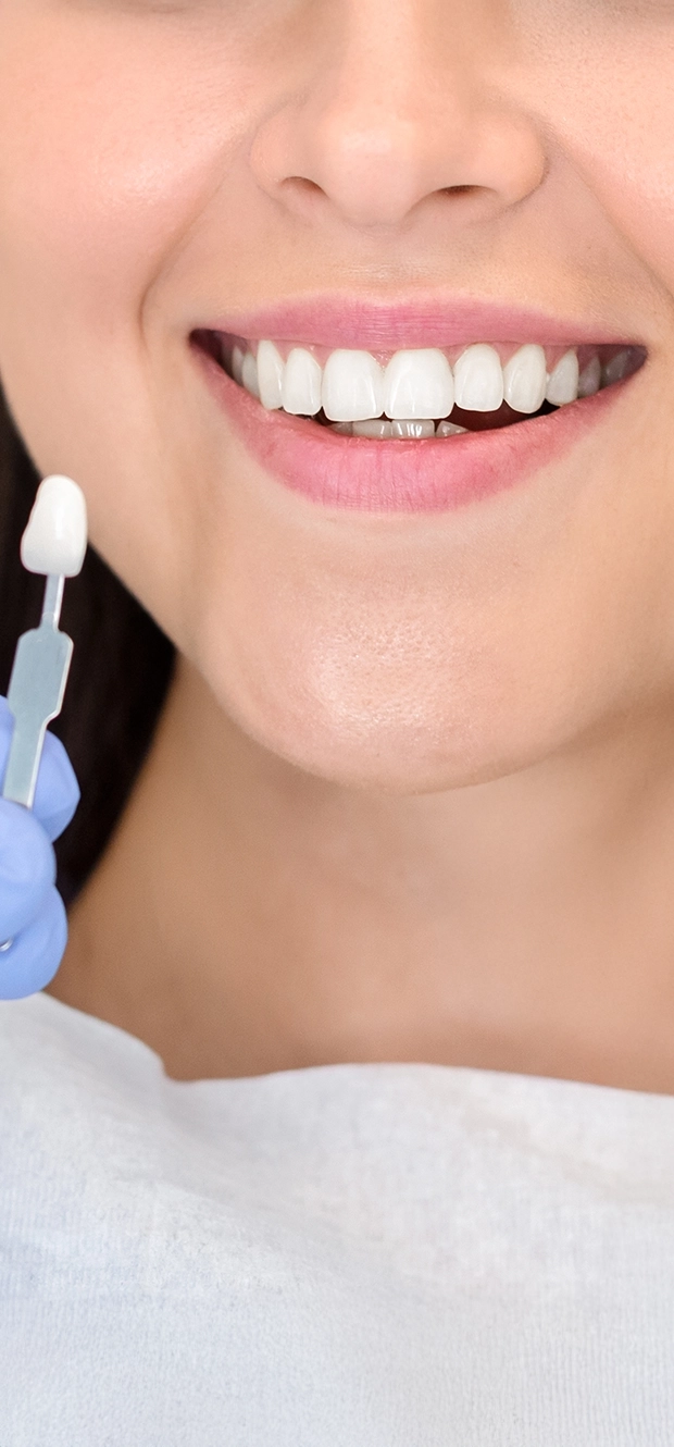 Branqueamento dentário